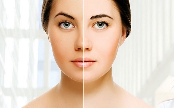 Skin Whitening Treatment